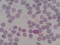 citra plasmodium  project thumbnail