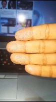 Right100 project thumbnail