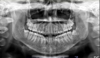 dentalai-360v1 project thumbnail