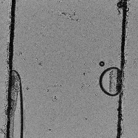 huvec-u937cell project thumbnail