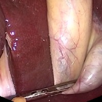 Detect_Tool project thumbnail