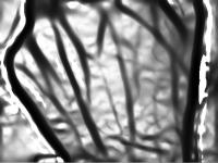 Unconstrained Hand Dorsal Veins project thumbnail