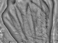 Unconstrained Hand Dorsal Veins 2 project thumbnail