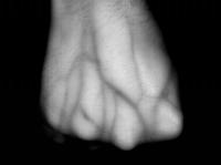 Dorsal Hand Vein Images Database project thumbnail