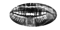 Dental project thumbnail