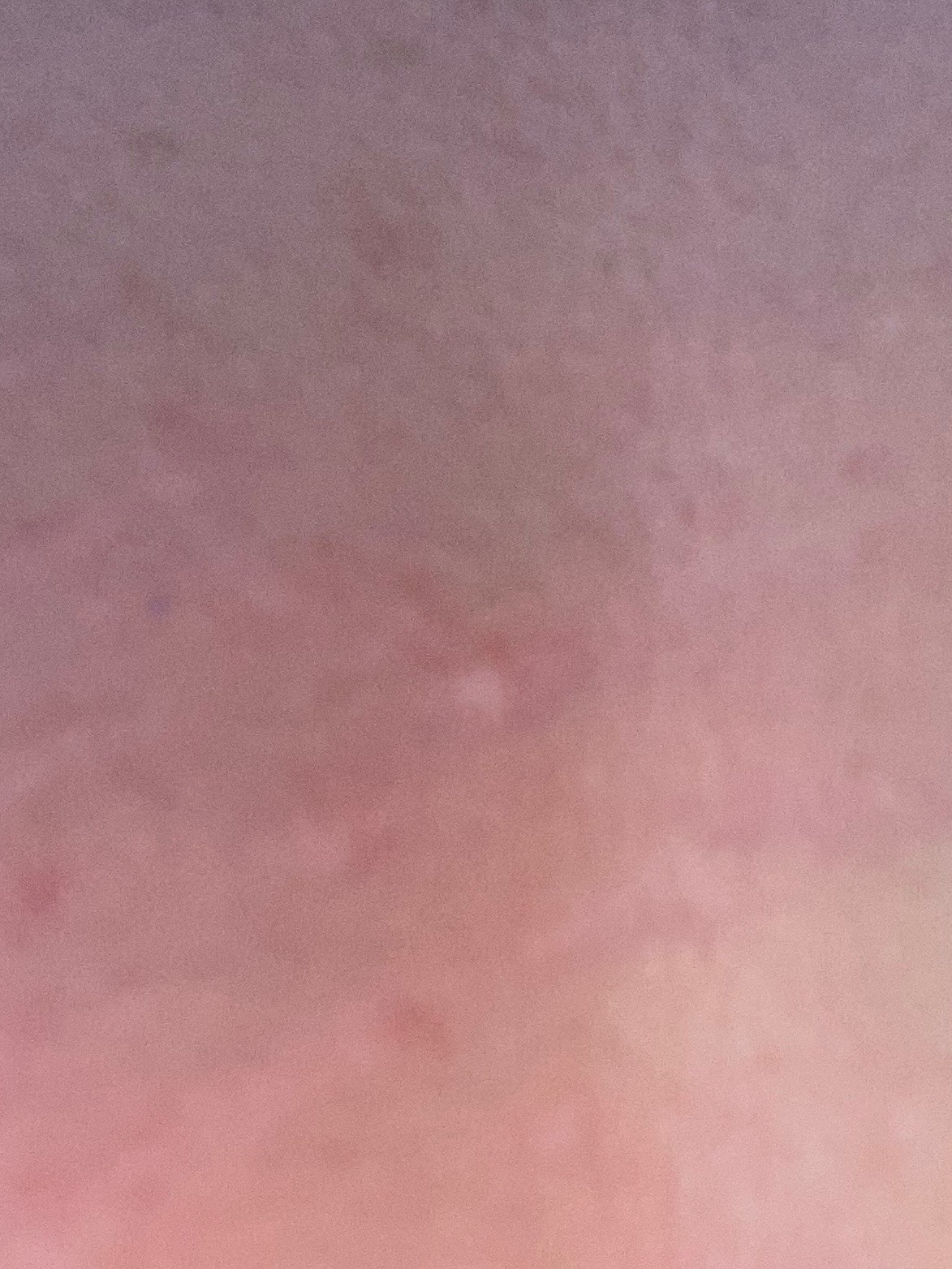 Skin Cancer Ai Final Classification Model By Xavi