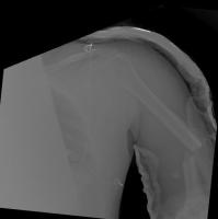 bone project thumbnail