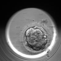 Automated Embryo Fragmentation A project thumbnail