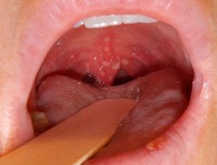 HFMD NEW project thumbnail