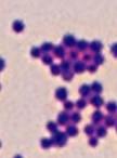 BIRAC project thumbnail