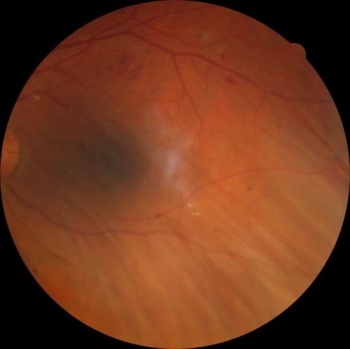 illnesses eye Object Detection Model by humam