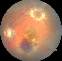 Dataset Image