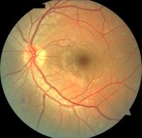 Dataset Image