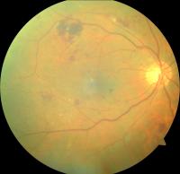 Dataset Image