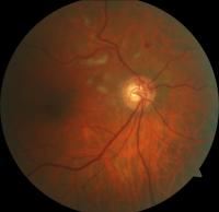 FUNDUS project thumbnail