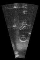 Marine-Debris project thumbnail