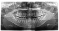 VLU đợt 3 (681 - 756) project thumbnail