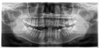 VLU đợt 2 (604-679) project thumbnail