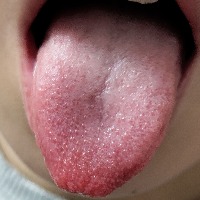 Tongue project thumbnail
