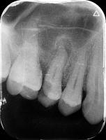 Radiograph Annotation project thumbnail
