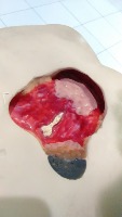 wound-manekins project thumbnail