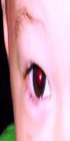 Detect one eyes reflex project thumbnail