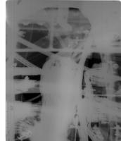 XRay-Image-Classification project thumbnail