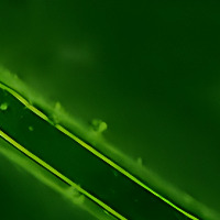 Partikelsegmentation project thumbnail