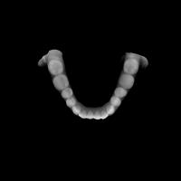 Dentes-Yolo project thumbnail