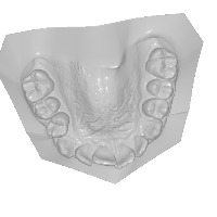 tooth project thumbnail