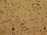 organoid project thumbnail