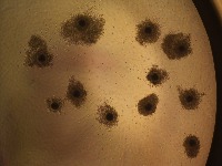 Egg detection project thumbnail