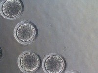 Egg segmentation-Zona project thumbnail