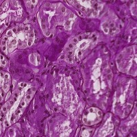 Microscopy Cell Segmentation project thumbnail