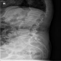 ntou-l1-to-l5-detection project thumbnail