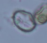 pollen project thumbnail