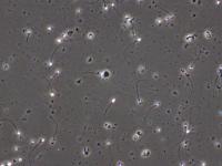 AI Sperm Detection 2 project thumbnail