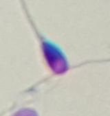 Sperm Dedecter project thumbnail