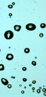 bubble-segmentation project thumbnail