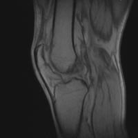Dataset_per_patient_YOLO project thumbnail