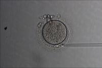 Polar Body project thumbnail