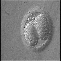  Oocyte project thumbnail