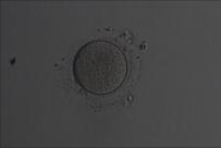 Fold-5 project thumbnail