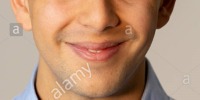 Smile Type Recognition project thumbnail
