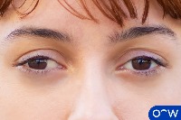 eye-disease project thumbnail