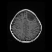 brain-tutor-segment project thumbnail
