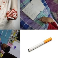 smoking detection Object Detection Model by kiyun