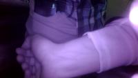 Vein Detection project thumbnail