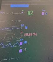 ICU vital signs project thumbnail
