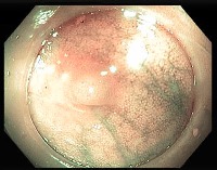 Zakir Polyps project thumbnail